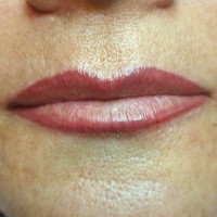 Modelo 1. Labios detalle después.