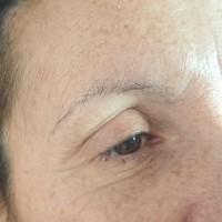 Modelo 1. Micropigmentación eye-liner antes. 